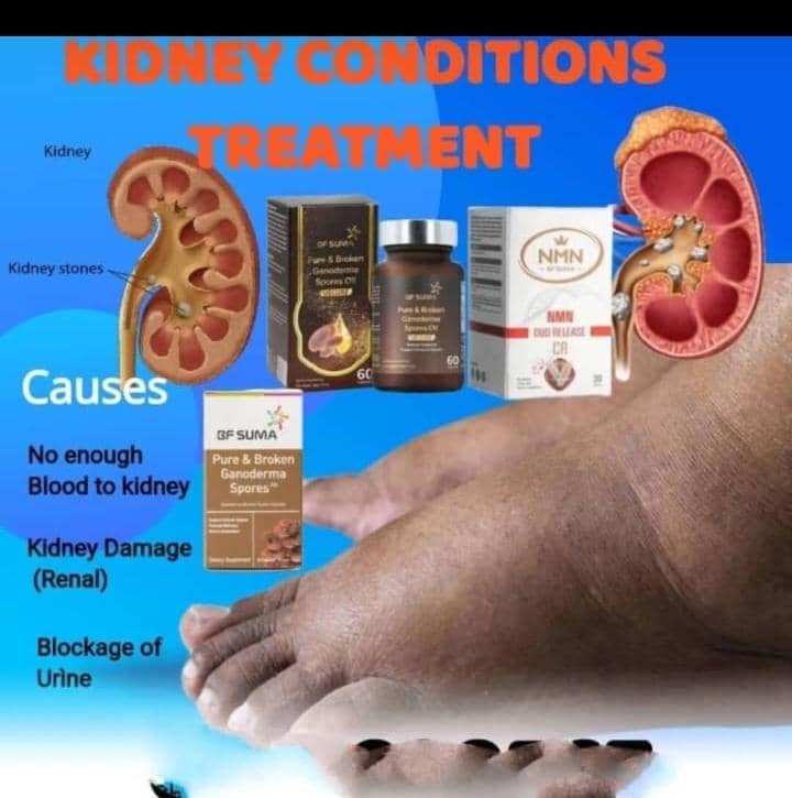 A GUIDE TO KIDNEY HEALTH